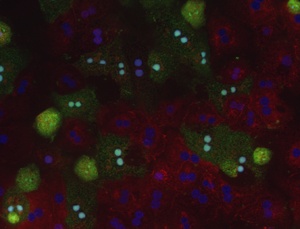 Medizin, die Leberversagen verhindert