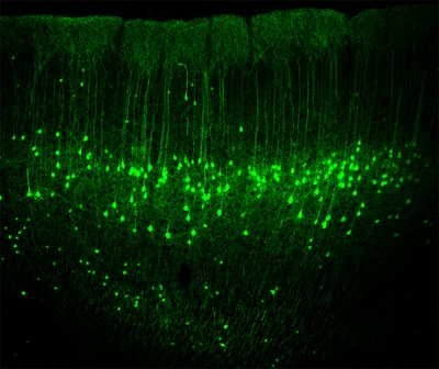 Neue Erkenntnisse zu neuronalen Aktivitäten im sensomotorischen Kortex
